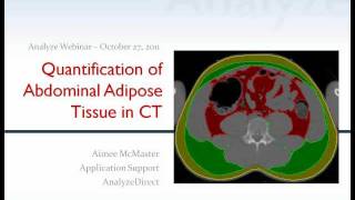 Quantification of Abdominal Adipose Tissue from CT using Analyze 100  Webinar [upl. by Garwood]