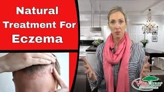 Eczema  Natural Treatment for Eczema  VitaLife Show 143 [upl. by Savory]