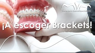 Ortodoncia ideal TIPOS DE BRACKETS  Ortodoncia MVM en Bogotá  Colombia [upl. by Engleman]