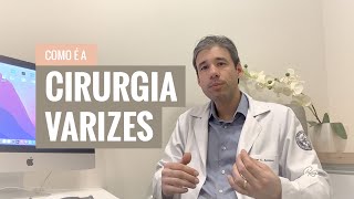 Cirurgia de Varizes  como é feita e opções [upl. by Teryn]