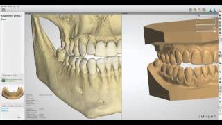 New Ortho Analyzer 2013 DICOM File Overlay [upl. by Marte]