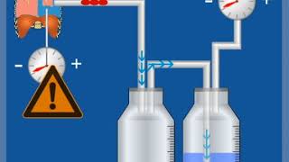 2KammerSystem mit Sog – Funktionsweise  Thoraxdrainage für Einsteiger [upl. by Ayanat]