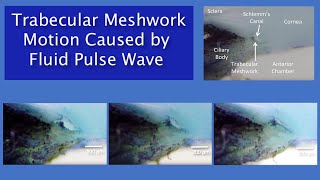 Trabecular Meshwork Pulseinduced Motion Video [upl. by Seuqcaj]