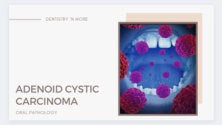 ADENOID CYSTIC CARCINOMA [upl. by Atteras]