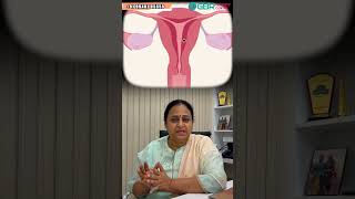 Daily sex is good for health  DrGBuvaneswari  GBR Fertility Centre educationalvideo doctor [upl. by Ecyarg]