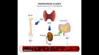 Hiperparatiroidismo [upl. by Timothea]