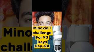 Minoxidil Challenge For 90 Days  Day24  trendingshorts viralreels viralshorts minoxidil hair [upl. by Rainah656]