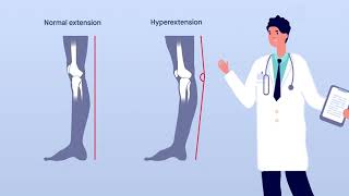 Multiple structures involved in preventing knee hyperextension [upl. by Vasti898]