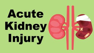 Acute Kidney Injury AKI  causes and management [upl. by Drannel278]