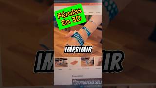 Férulas o tablillas gratis en 3D  Como imprimir férulas o tablillas con tu impresora 3D [upl. by Nickey]