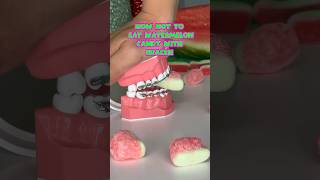 How NOT to eat WATERMELON CANDY with BRACES what to eat instead braces watermelon candy [upl. by Calderon]