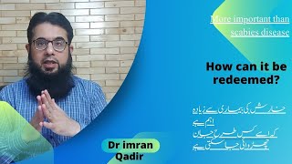 Important information for scabies treatment  خارش کی بیماری میں کیا اہم ہے؟ Dr imran Qadir [upl. by Zetnod507]