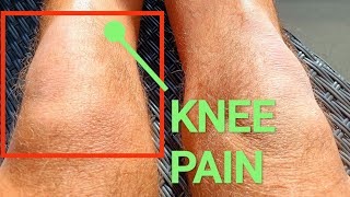 HEAL KNEE PAIN FASTER  PATELLAR TENDONITIS  PRIMAL HEALING PROTOCOL [upl. by Buffum]