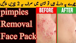 Pimples Removal Face Pack  بیسن میں صرف 2 چیزیں ملائیں اور دانے ہمیشہ کے لیے ختم 💯 فیصد رزلٹ [upl. by Nanci]