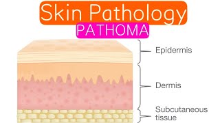 Skin Pathology PATHOMA 1  Introduction  Inflammatory Dermatosis [upl. by Aicileb87]