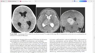 PAEDIATRIC IMAGING [upl. by Okiron457]