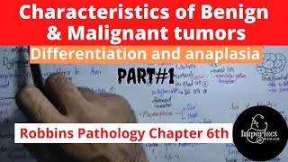 Characteristics of Benign and Malignant tumorsDifferentiation and anaplasiaDymoplasia neoplasia [upl. by Lallage]