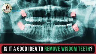 Part 74 Is it a good idea to remove wisdom teeth  DR MAI [upl. by Suivatram]