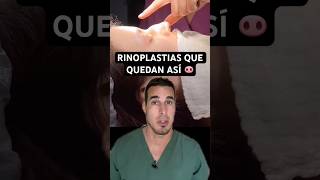 Se OPERAN la NARIZ y quedan PEOR 🐽  Esta RINOPLASTIA le cambió hasta los LABIOS [upl. by Nnylecyoj]