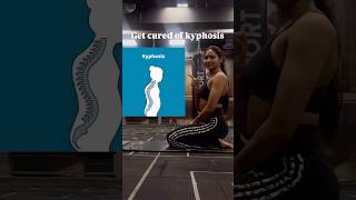 Do yoga for kyphosis [upl. by Stoat675]