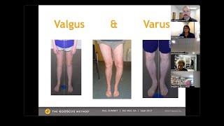 Egoscue knee pain webinar  full recording [upl. by Ahtelat]