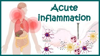 Acute Inflammation  symptoms Pathogenesis Cause of inflammation Mediators of Acute Inflammation [upl. by Rankin]