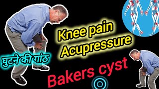 Bakers Cyst Treatment By Acupressure Points  घुटने के पीछे की गांठ का ईलाज  Knees Pain [upl. by Auerbach351]