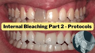 Internal Whitening Protocols Part 2 Non Vital Bleaching  PDP147 [upl. by Althee20]