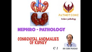 Congenital Anomalies of Kidney [upl. by Bastien]