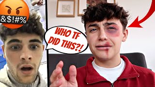 I GOT BEAT UP PRANK ON FIANCE Gay Couple Edition [upl. by Cissej]