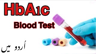 HbA1c Blood Test In Urdu  HbA1c Test for Diabetes  Hemoglobin A1c Test Normal LowHigh Levels [upl. by Akimak]