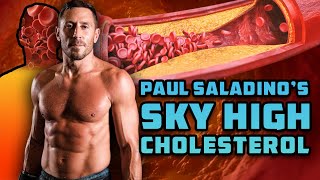 Paul Saladino On His Sky High Cholesterol Levels And What Actually Causes Atherosclerosis [upl. by Malley565]