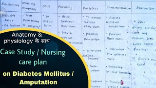 Diabetes Mellitus Nursing care plan  Amputation case study  BSc amp GNM Nursing  case presentation [upl. by Cho892]