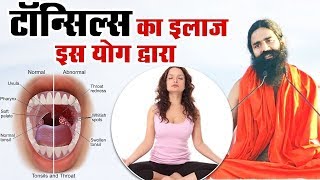 Right Way To Do Yoga  Swami Ramdev Ji  उज्जायी प्राणायाम के लाभ [upl. by Zul466]