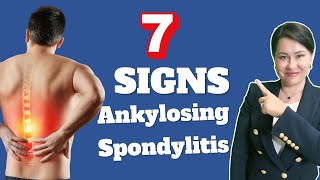 7 Signs of Ankylosing Spondylitis  A Rheumatologist Review [upl. by Clemence]