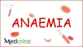 Anemia  causes classification clinical features treatment [upl. by Arinayed939]