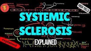 SCLERODERMA Systemic sclerosis Pathogenesis Diagnostic criteria Classification EULAR Treatment [upl. by Nyrek]