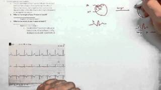 ECG Library Supplement Hennager AP2 ECG Labmov [upl. by Roshelle137]