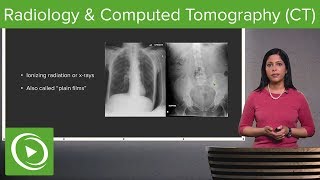 Radiology and Computed Tomography CT – Radiology  Lecturio [upl. by Kahn]