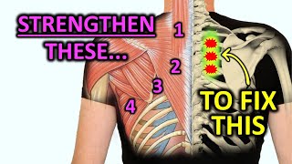 Strengthen These Muscles To Fix Rhomboid Pain [upl. by Ettebab]