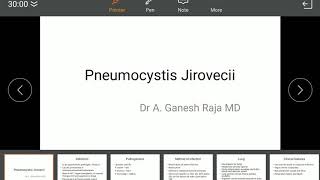 Pneumocystis Pneumonia [upl. by Anivlem]