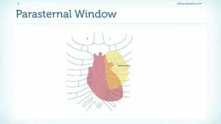 Introduction to the Parasternal Window [upl. by Ynej]