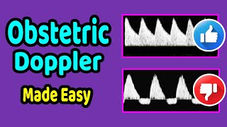 Obstetric Doppler Made Easy [upl. by Entwistle]