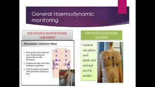 Haemodynamic monitoring Invasive Blood Pressure Measurement [upl. by Ahcsap]