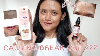 I tried rosehip oil for 3 weeks on my acne prone skin ⎮ English ⎮ Vlog 40 [upl. by Phelia]