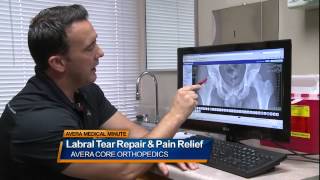 Labral tear repair and pain relief  Medical Minute [upl. by Cuthburt]