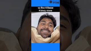 Kidney stone treatment  Retrograde Intrarenal Surgery  FANS RIRS shortsviral [upl. by Yssim376]