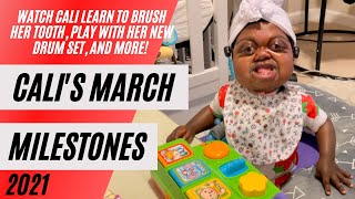 Calis March Development Milestones  14 Month Infant Special Needs Pfeiffer Syndrome [upl. by Tarsuss]