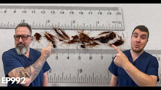 INSANE Amount Of Hair Removed From My Ear Canal  EP992 [upl. by Yartnoed122]