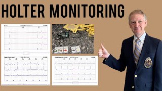 Holter Monitor  Everything you need to know [upl. by Ayvid]